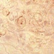 Maple (Burl) - Acer saccharum